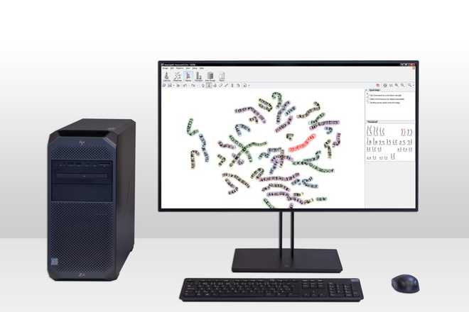 lucia cytogenetics karyotyping image